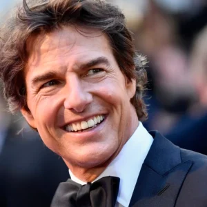 Celebrities with Teeth Implants before and after